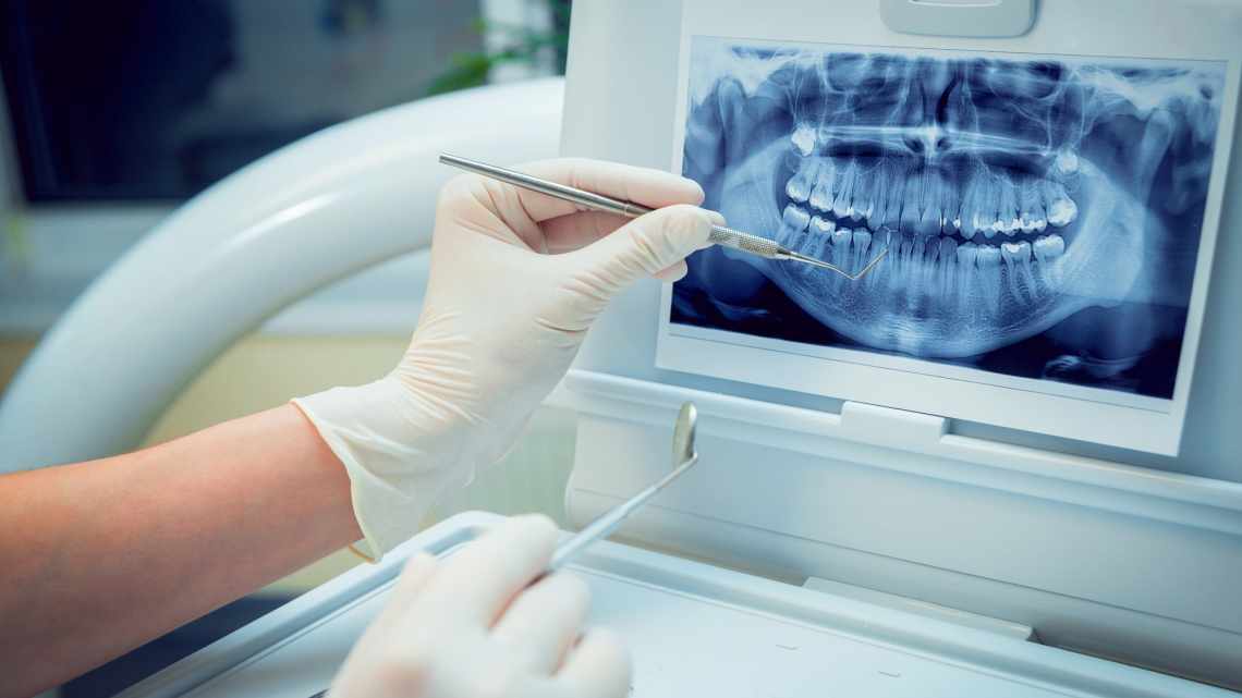 Рентген у стоматології