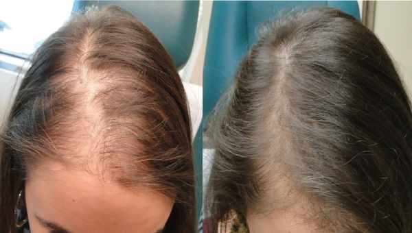 Незмивні креми, які повертають волосся до життя після першого разу