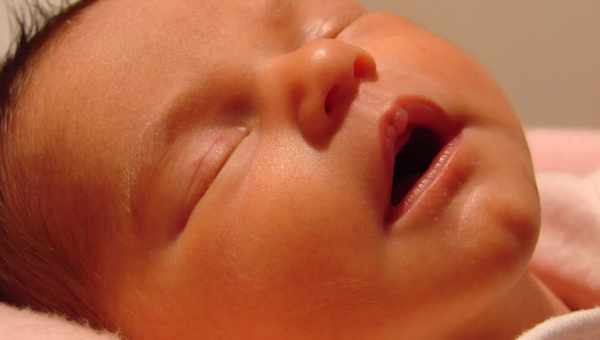 Мозоль на губі у новонародженого