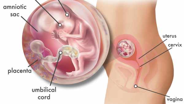 Шар плаценти на ранніх термінах вагітності