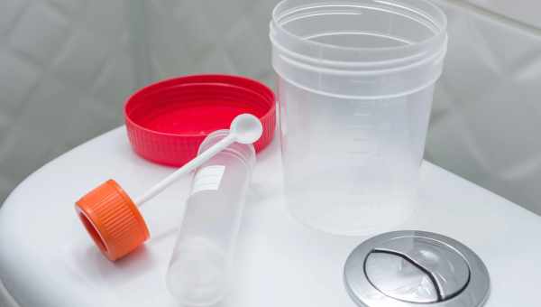 Проба на наявність кала з кров'ю та інші лабораторні дослідження калу при вагітності