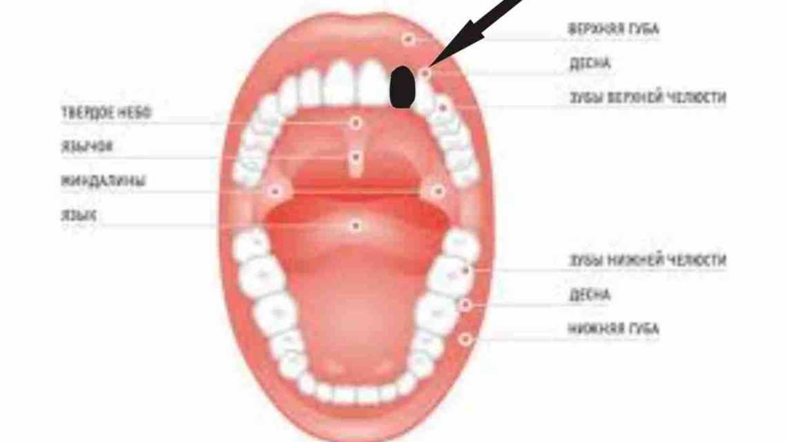 Біль, поганий запах, гіркота в роті - діагноз лежить у ротовій порожнині