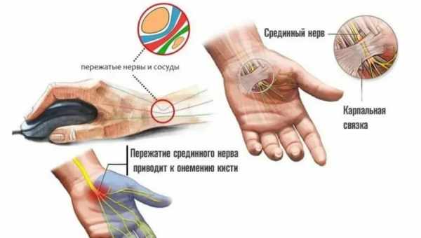 Чому трясуться руки - можливі причини. Дізнайтеся, чому тремтять руки і як від цього позбутися