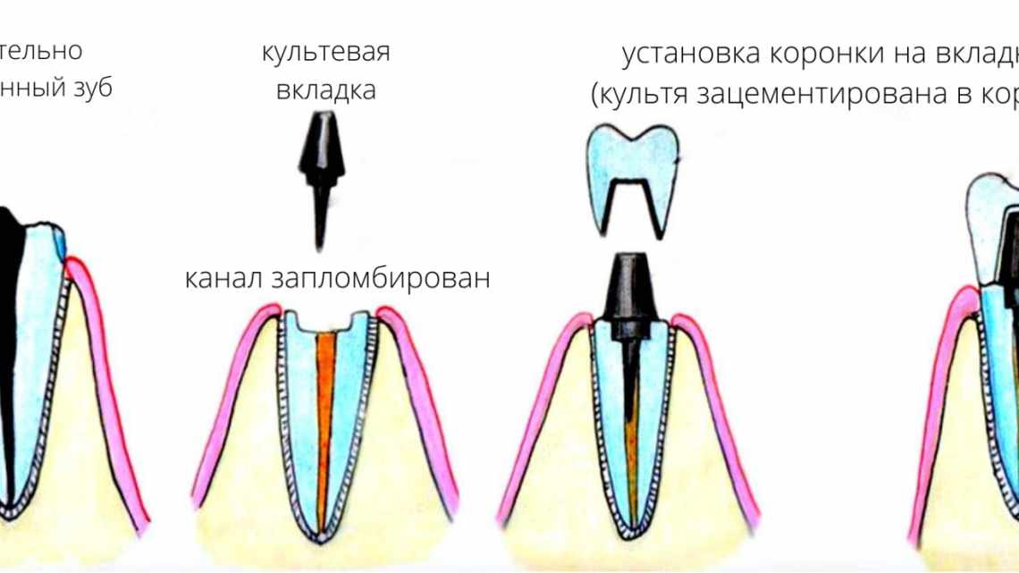 Як зберегти вкладки в Сафарі після закриття