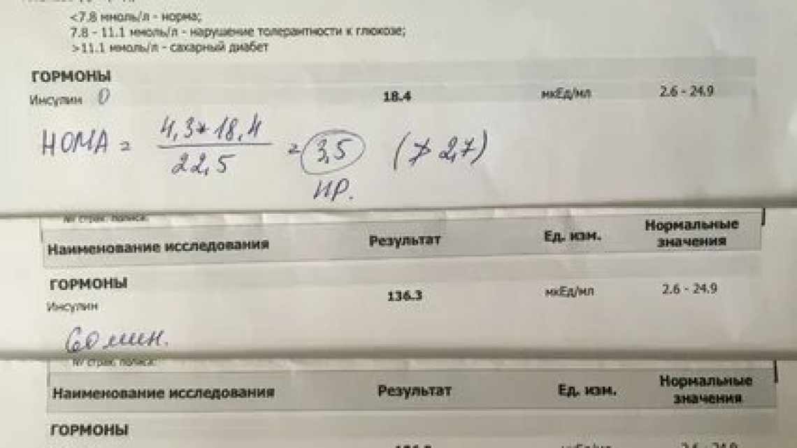 Норма глюкози у дітей, що робити при відхиленнях показника