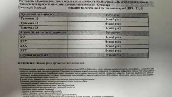 Генетичний аналіз пов'язав рівень інтелекту з патологіями зору і хворобами серця