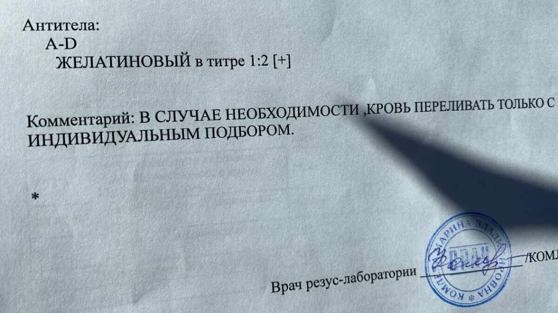 Нижня скронева область мозку макак-резусів змогла відрізнити різні слова і букви