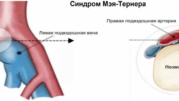 «Синдром Лазаря»: чому «мертві» іноді оживають і чи є наукове пояснення цього феномена?